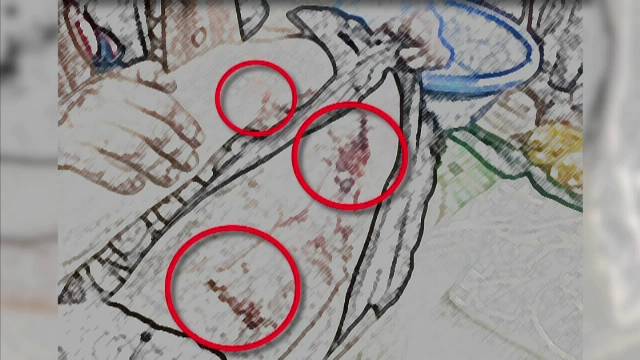 ผลตรวจสภาพร่างกายผู้เสียชีวิต วิสามัญฆาตกรรม