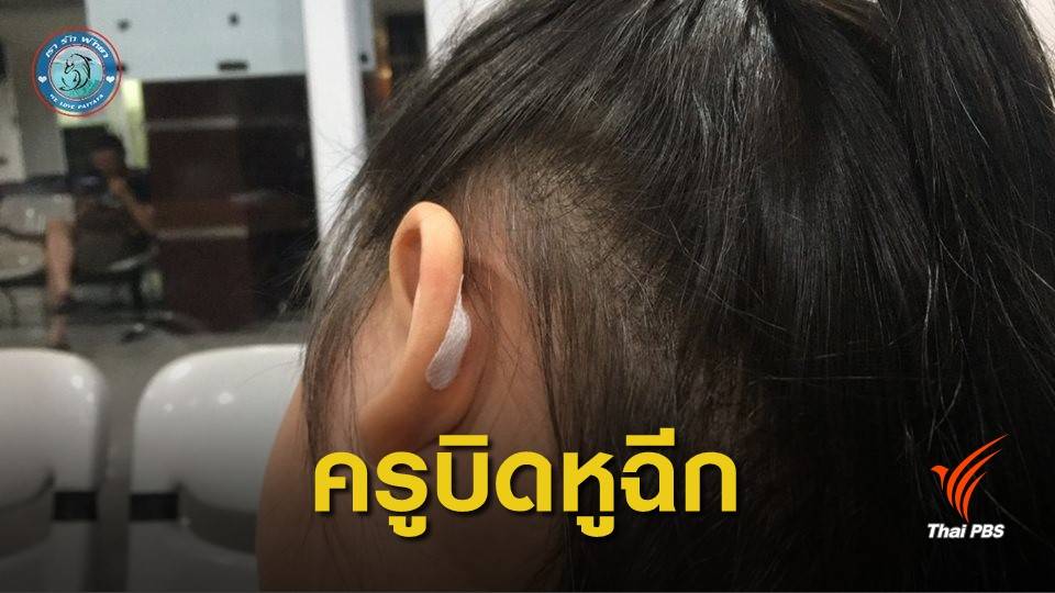 แม่โร่แจ้งความ ครูพี่เลี้ยงบิดหูลูก 5 ขวบจนเป็นแผลฉีก