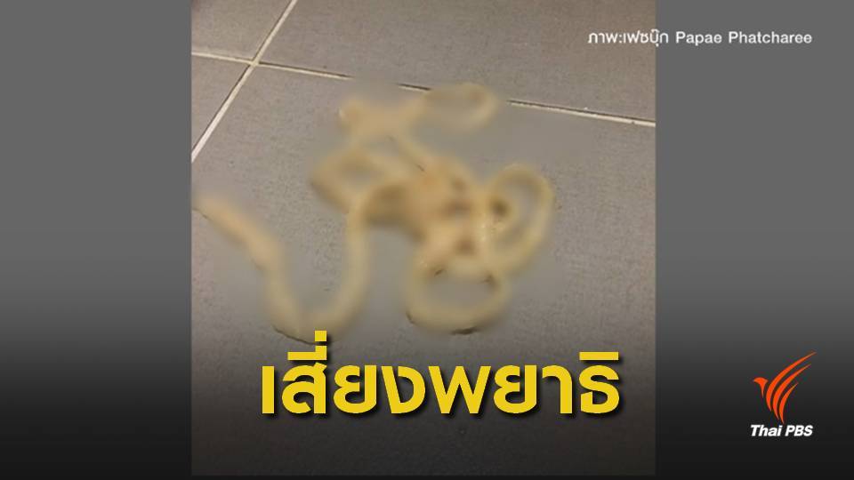 เตือนกิน "เนื้อ-หมู"สุกๆดิบๆ เสี่ยงเจอลูกพยาธิตัวตืดฝังในร่างกาย