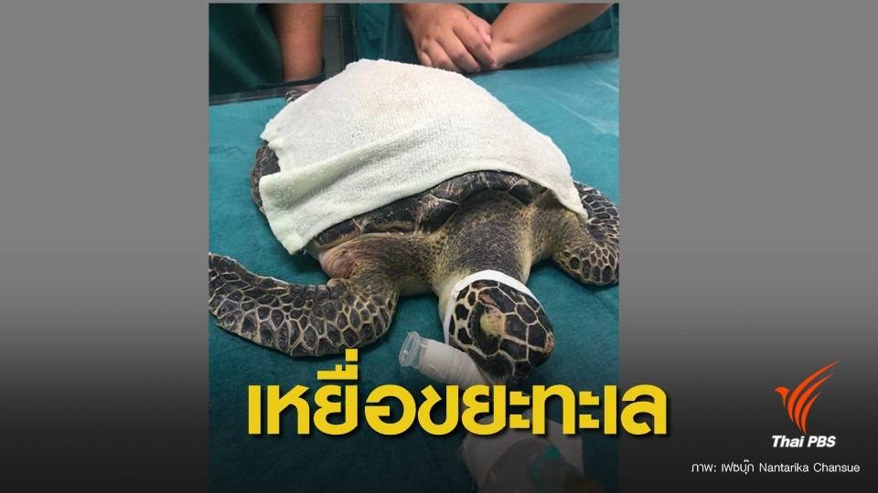 เหยื่อตัวล่าสุด ! ผ่าตัดสำเร็จ “เทรสซี่” เต่าทะเลเกยตื้นขยะเต็มท้อง