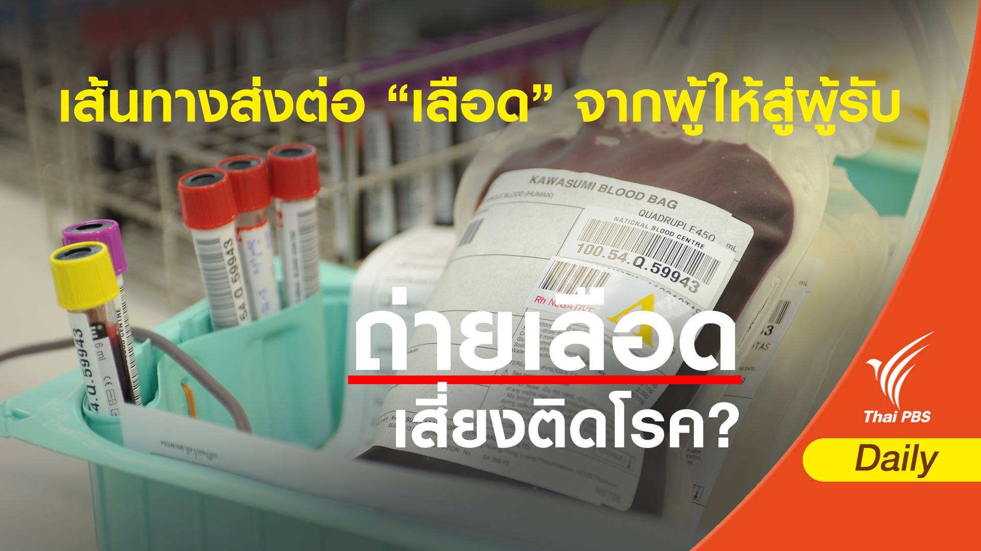 สภากาชาดระบุทำดีที่สุด คัดกรองเลือดละเอียดทุกถุง วอนผู้บริจาคช่วยกรองขั้นต้น