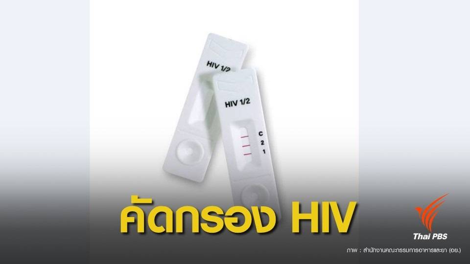 อย.ปลดล็อก "ชุดตรวจ HIV" ซื้อจากร้านขายยาตรวจเองได้