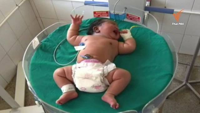 หญิงอินเดียวัย 19 ปี คลอดทารกเพศหญิงน้ำหนักถึง 6.8 ก.ก. หนักสุดในประเทศ