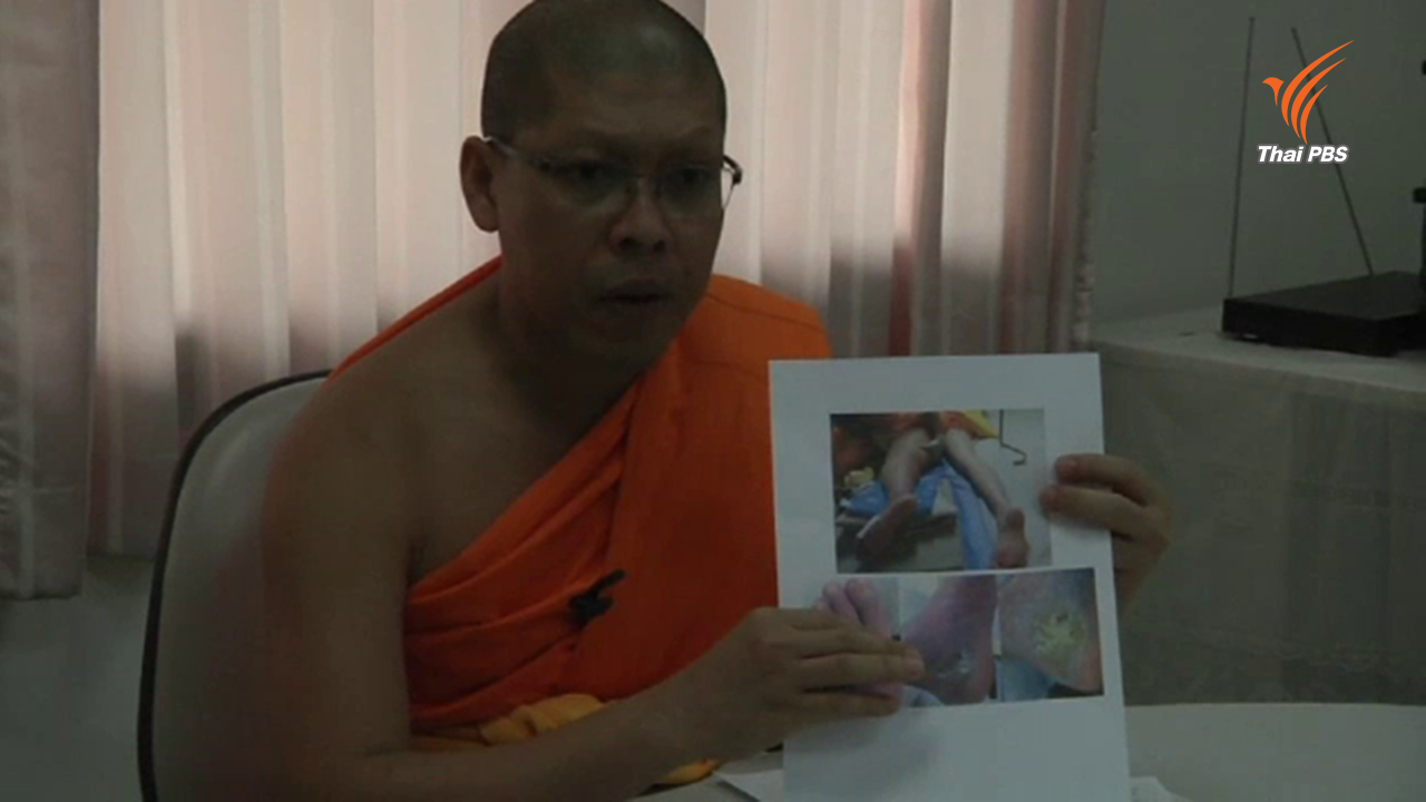 ธรรมกายจ่อแถลงคืบหน้าอาการอาพาธ "พระธัมมชโย" บ่ายนี้