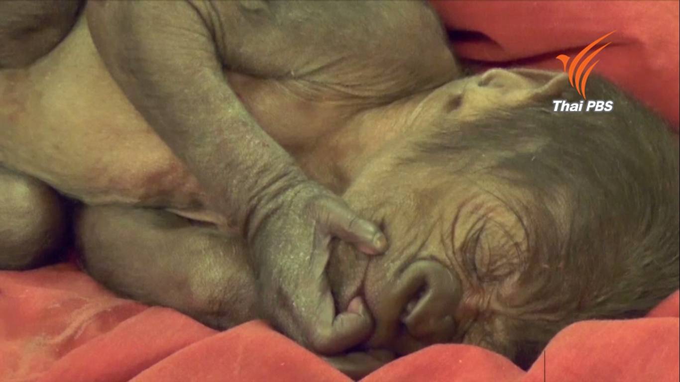 แพทย์อังกฤษทำคลอดฉุกเฉินแม่กอริลลาครรภ์เป็นพิษ ปลอดภัยทั้งแม่-ลูก