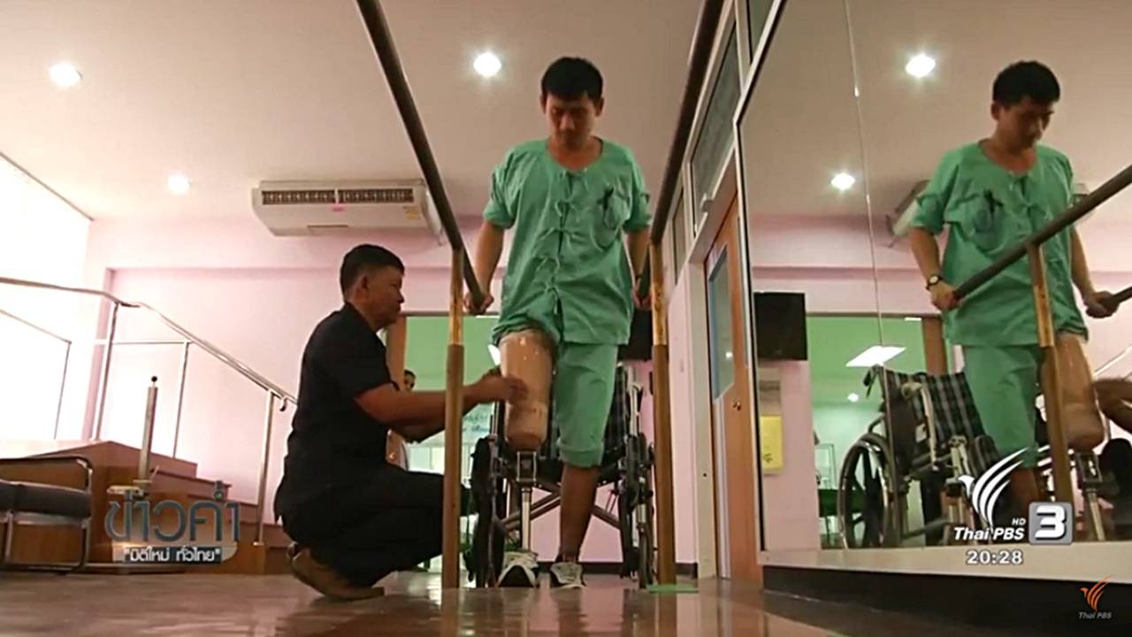 แขนเทียม-ขาเทียมเพื่อชีวิตใหม่ พระมหากรุณาธิคุณของในหลวงต่อผู้พิการ 