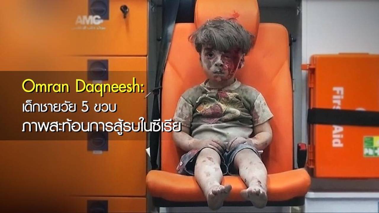 พี่ชายของ "ออมราน ดัคนีช" เด็กชายในภาพสงครามซีเรีย เสียชีวิตแล้ว