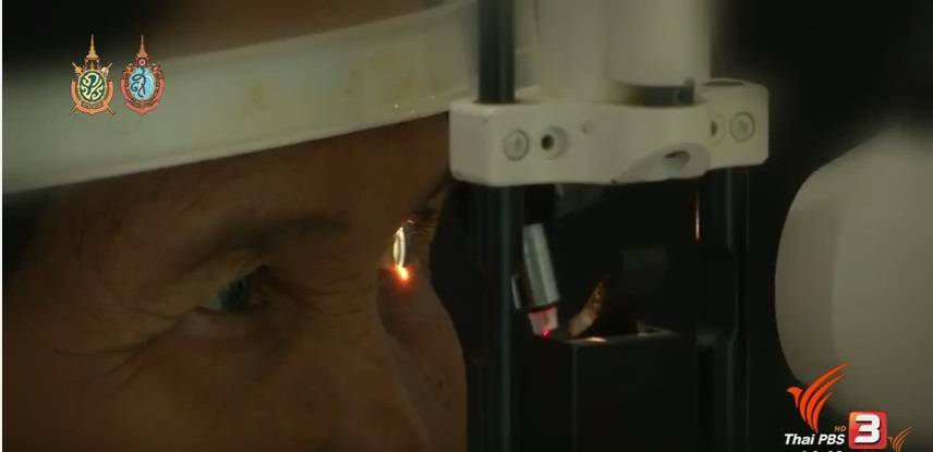 ผู้สูงอายุชายแดนใต้ "ปลื้ม"สถาบันพระปกเกล้าผ่าตัดแก้ต้อกระจกฟรี 