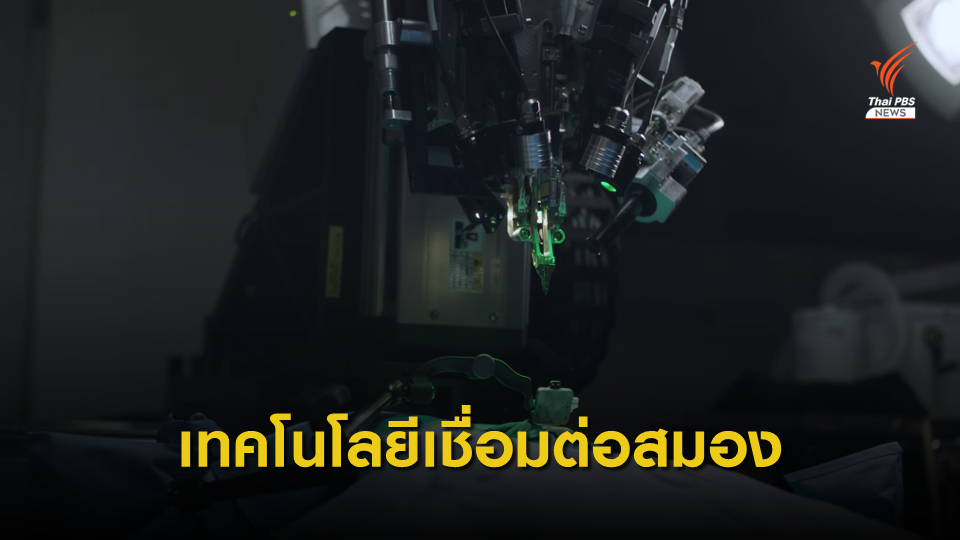 บริษัทเอกชนในสหรัฐฯ พัฒนาเทคโนโลยีเชื่อมสมองกับคอมพิวเตอร์