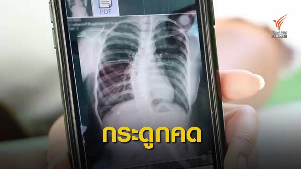 "คุณหญิงกัลยา" เสนอใช้ E-book แก้ปัญหา นร.สะพายกระเป๋าหนัก