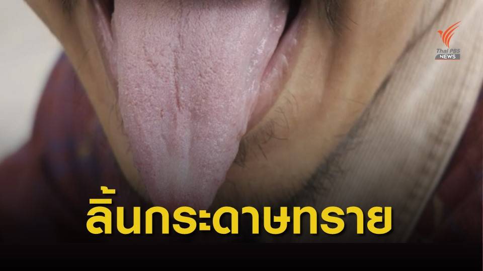 เพียงคำเดียว "ลิ้น" ในสำนวนสื่อคำพูด