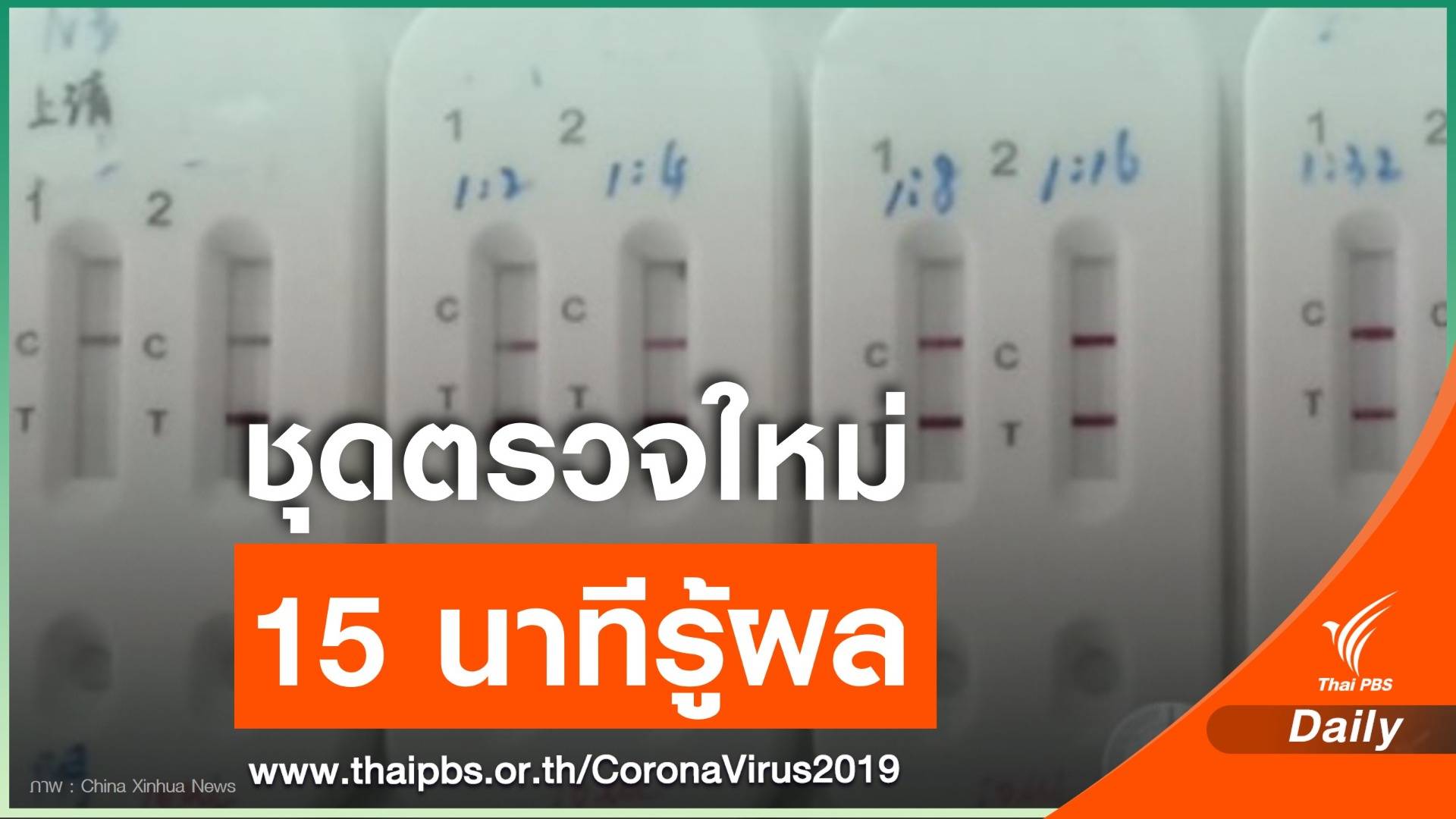 จีนพัฒนาชุดตรวจ COVID-19 ใช้เลือด 1 หยด รู้ผลใน 15 นาที