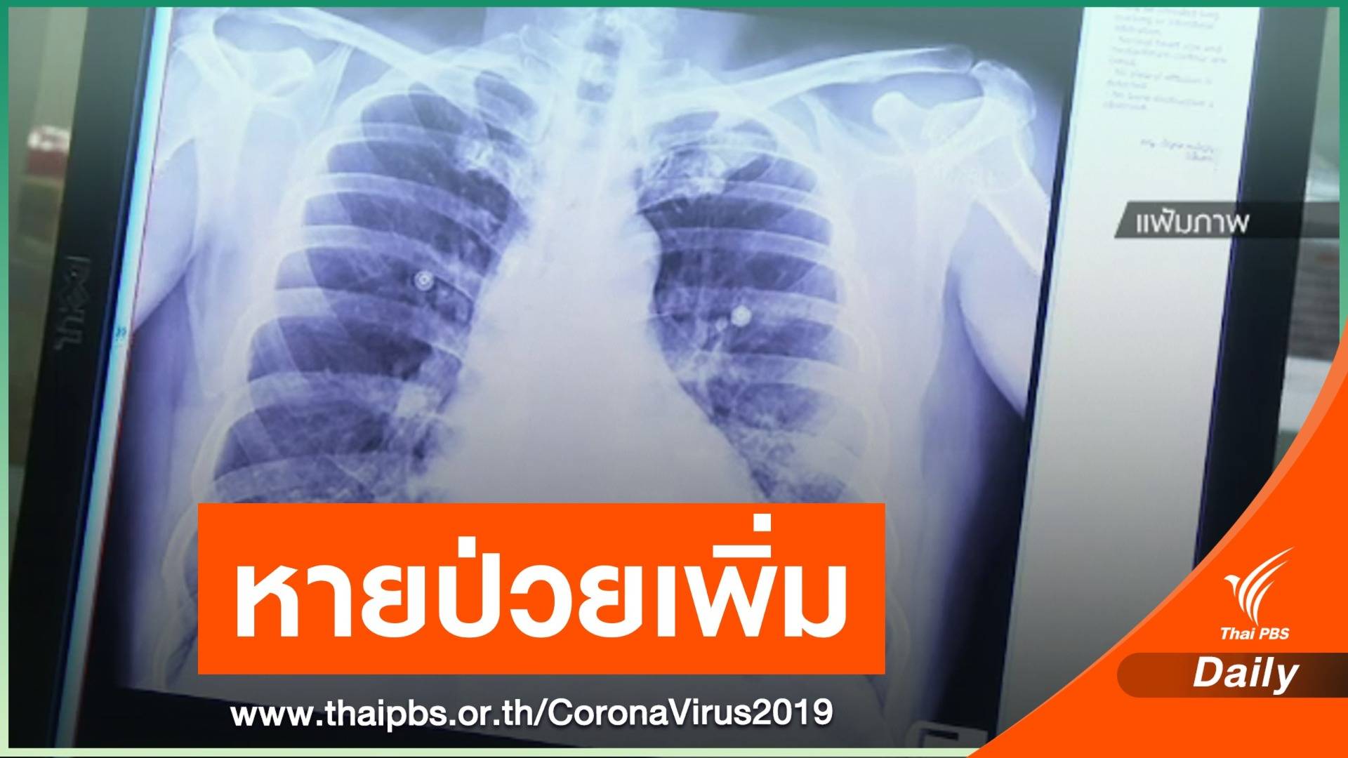 ข่าวดี! คนไทยติดเชื้อ COVID-19 หายป่วยกลับบ้านเพิ่ม 1 คน