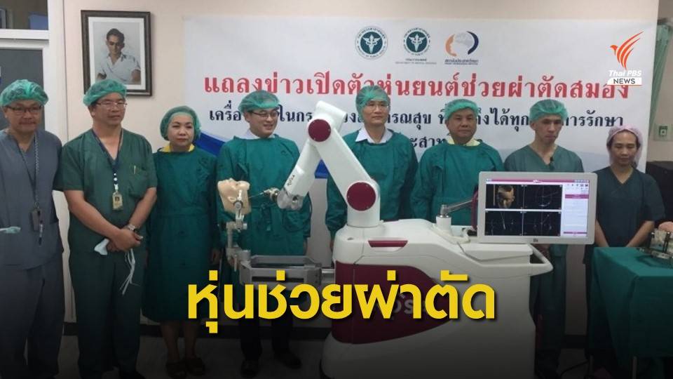 เปิดตัว "หุ่นยนต์ช่วยผ่าตัดสมอง" ผู้ป่วยลมชักเครื่องแรกในไทย