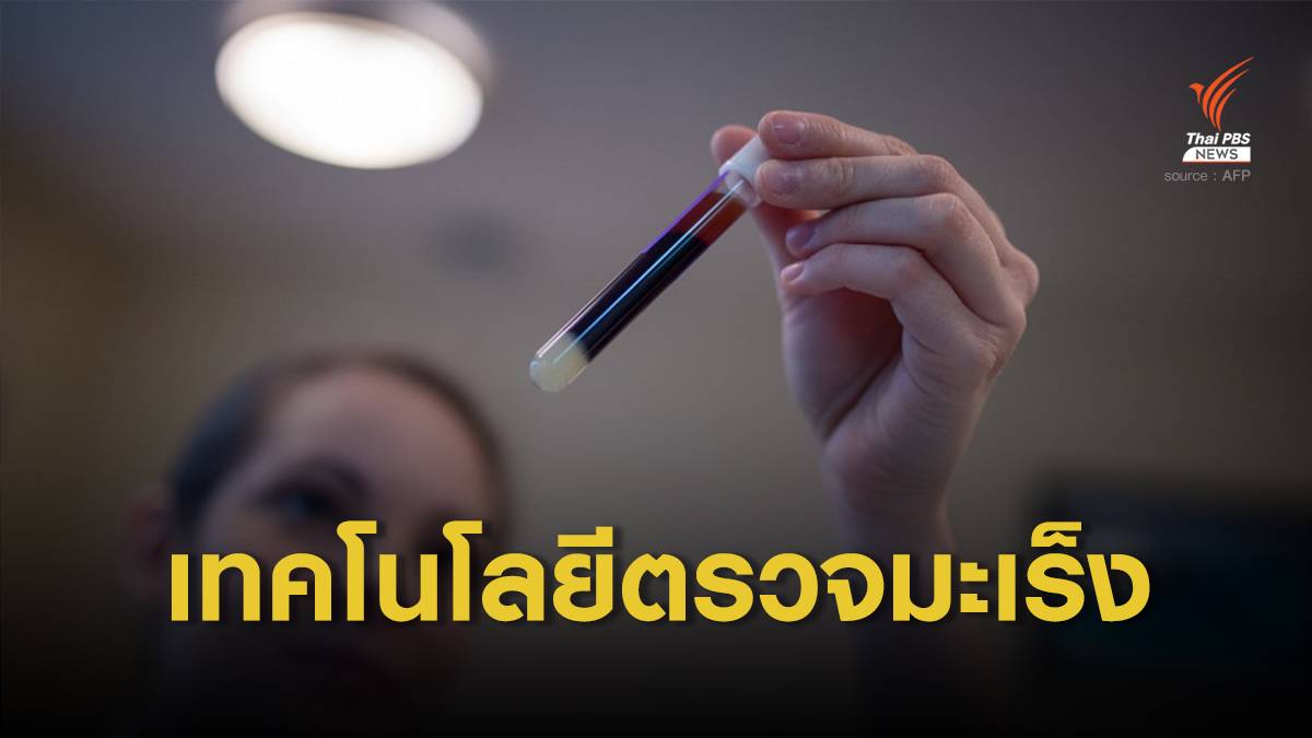 เทคโนโลยีตรวจหามะเร็งด้วยเลือดหยดเดียว ภายใน 2 ชั่วโมง