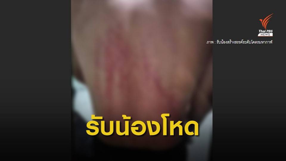 ม.ดังเชียงใหม่ เร่งเอาผิด "รุ่นพี่" รับน้องรุนแรง