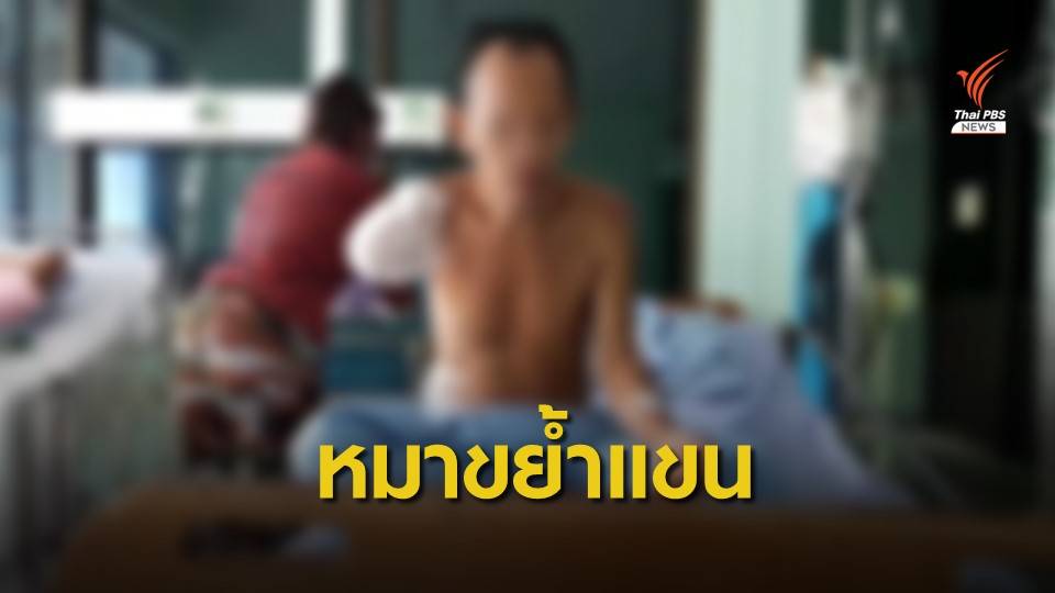 ตัดแขนขวาสังเวย "ร็อตไวเลอร์" ขย้ำเจ็บสาหัส