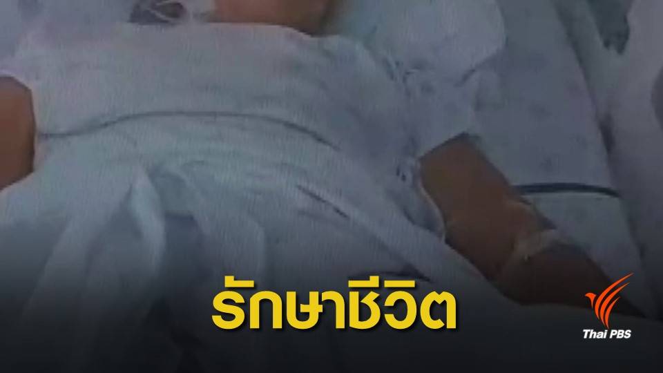 มอ.ออกแถลงการณ์ "ตัดขารักษาชีวิต" สาวถูกสุนัขกัด