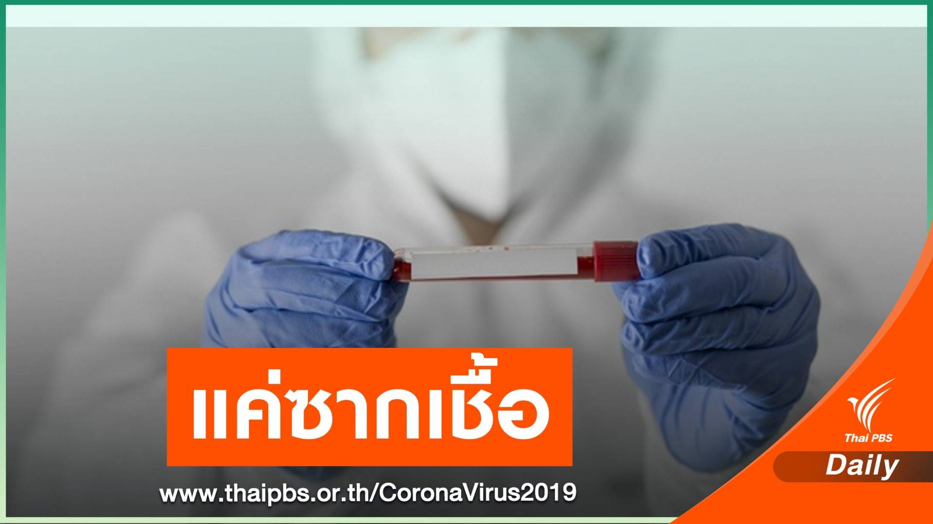 แค่ซากเชื้อ! สธ.แจงกรณีพบชาย 49 ปีมีเชื้อ COVID-19