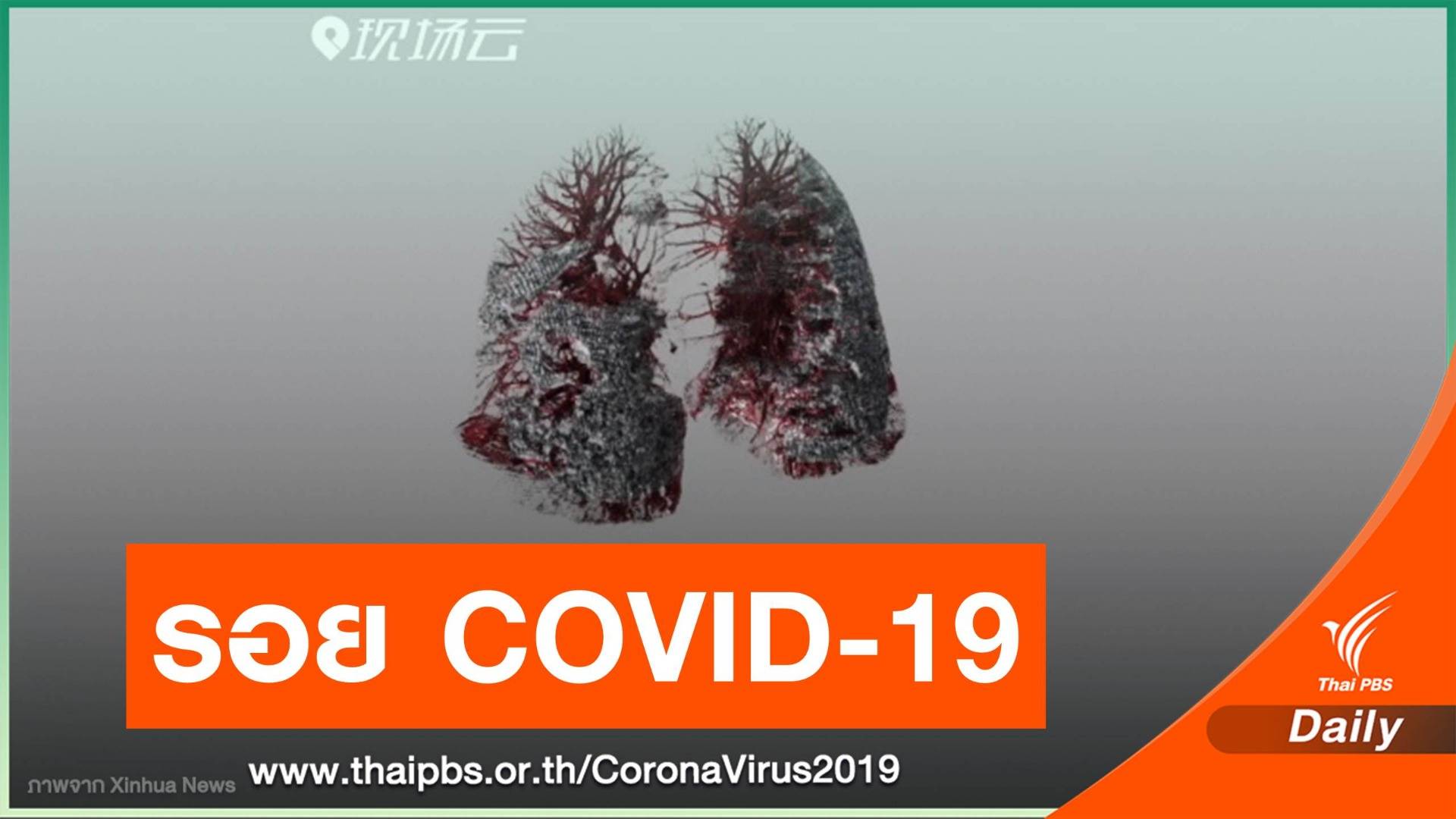 นักวิจัยจีนพัฒนา "AI สร้างภาพปอด" ฉายรอยโรค COVID-19 
