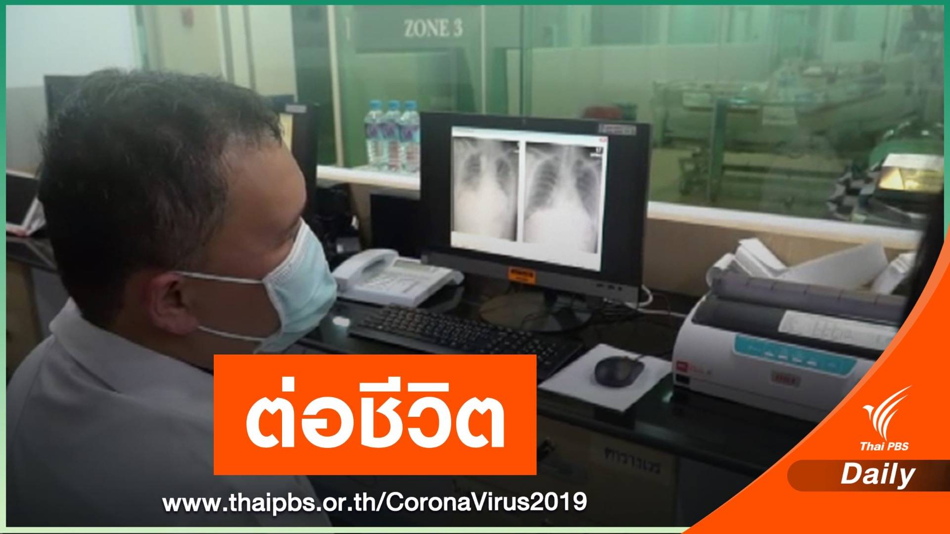 เปิดใจทีมแพทย์-ผู้บริจาค "พลาสมา"ต่อชีวิตผู้ป่วยสำเร็จ