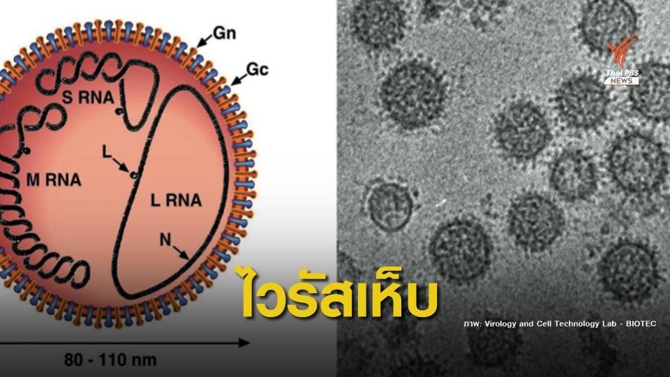 รู้จักโรค "ไวรัสเห็บ" เริ่มพบระบาดจีน-ไทยยังไม่มีรายงาน