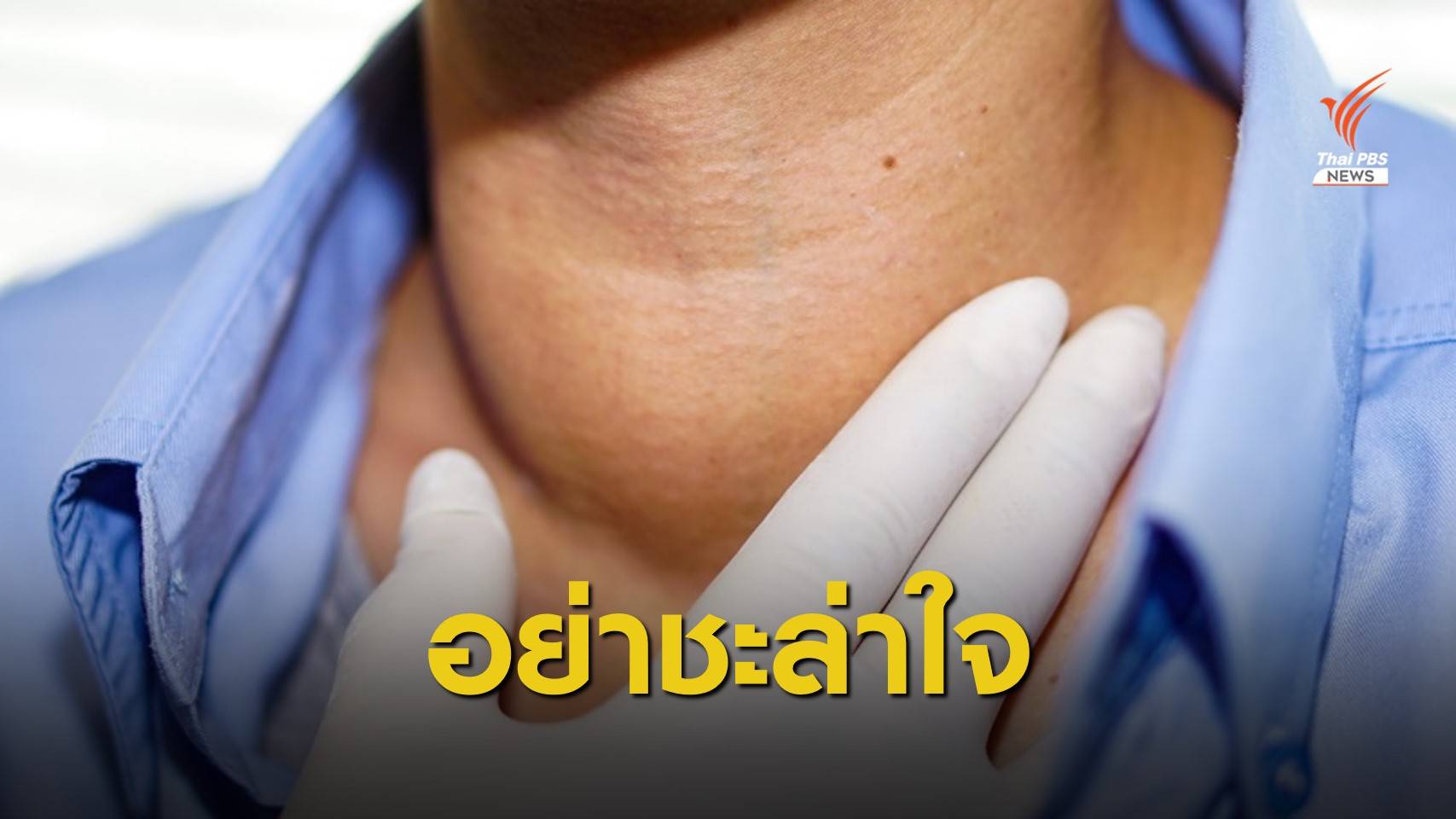 คลำพบก้อนที่คอเสี่ยง "มะเร็งไทรอยด์" ตรวจเร็ว รักษาหาย