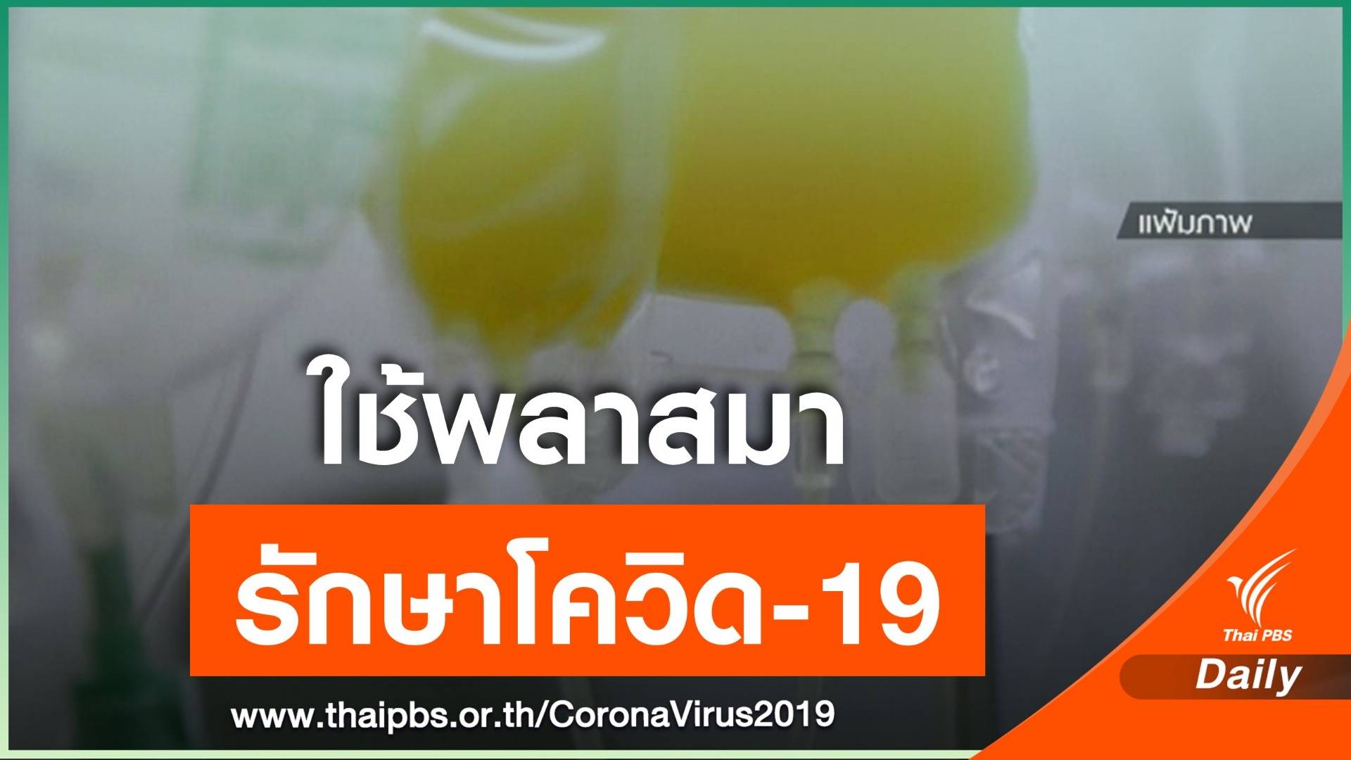 สหรัฐฯ ไฟเขียวใช้พลาสมารักษาผู้ป่วย COVID-19