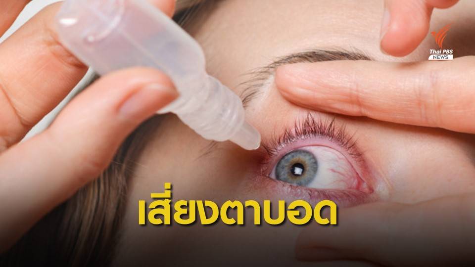 เตือนอย่าหลงเชื่อ "น้ำยาหยอดตานาโน" แก้สายตาสั้น-ยาว