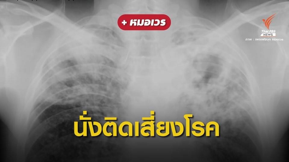 หมอเตือน! รู้ทัน "วัณโรคปอด" นั่งข้างกันติดได้