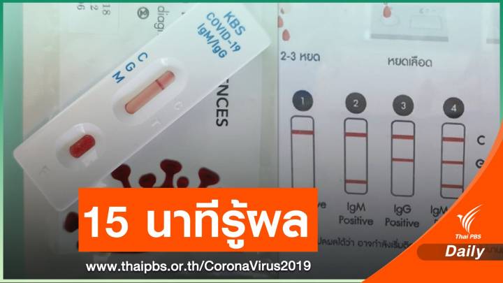 ทีมวิจัย ม.อ.ผลิตชุดตรวจ COVID-19 รู้ผลใน 15 นาที 
