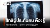 รู้สิทธิ ผู้ประกันตน ม.33, 39 ตรวจสุขภาพฟรี 14 รายการ รวมถึง "เอกซเรย์ปอด" 