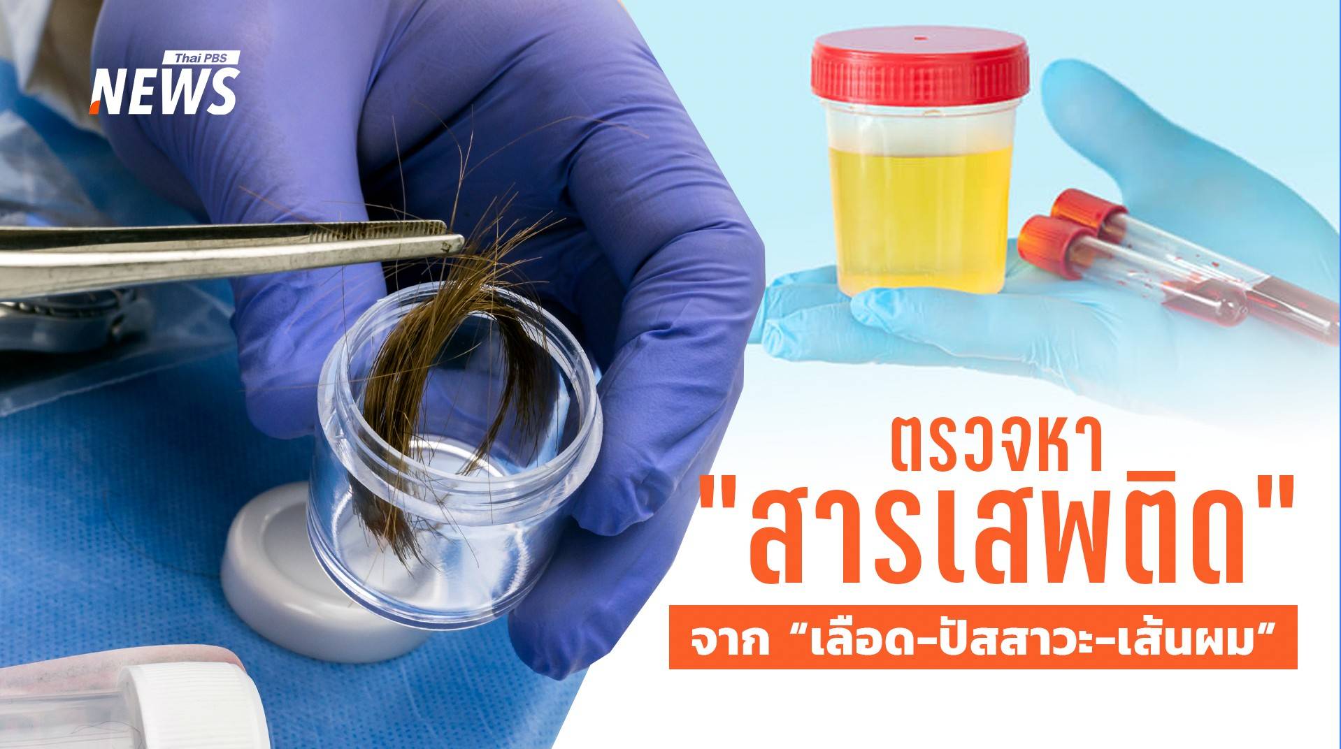 หาคำตอบ ตรวจหา "สารเสพติด" จาก "เลือด-ปัสสาวะ-เส้นผม" ต่างกันอย่างไร