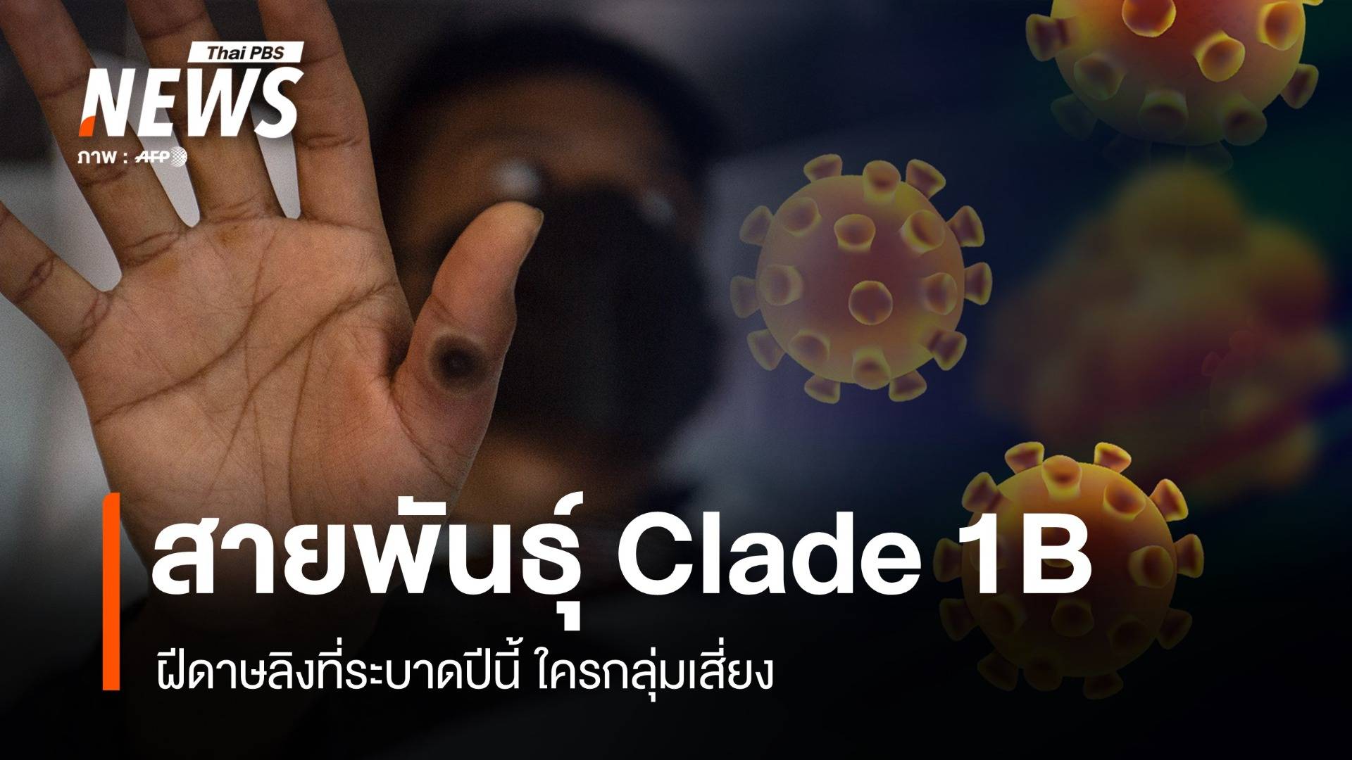 เช็กอาการฝีดาษลิงสายพันธุ์ "Clade 1B " ใครกลุ่มเสี่ยง