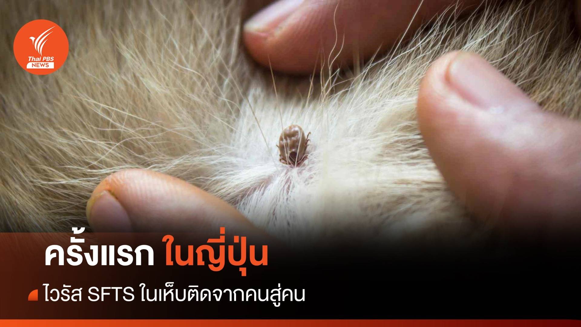 ครั้งแรก! NIID ญี่ปุ่นรายงานพบ "ไวรัส SFTS เห็บ" ติดคนสู่คน