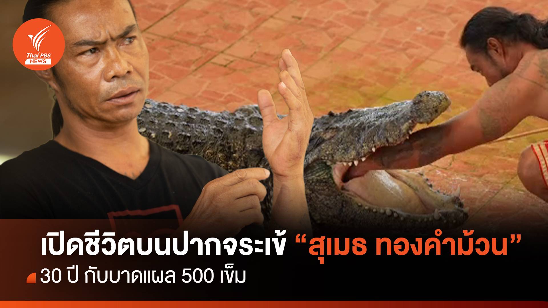 เปิดชีวิตบนปากจระเข้ "สุเมธ ทองคำม้วน" 30 ปี กับบาดแผล 500 เข็ม