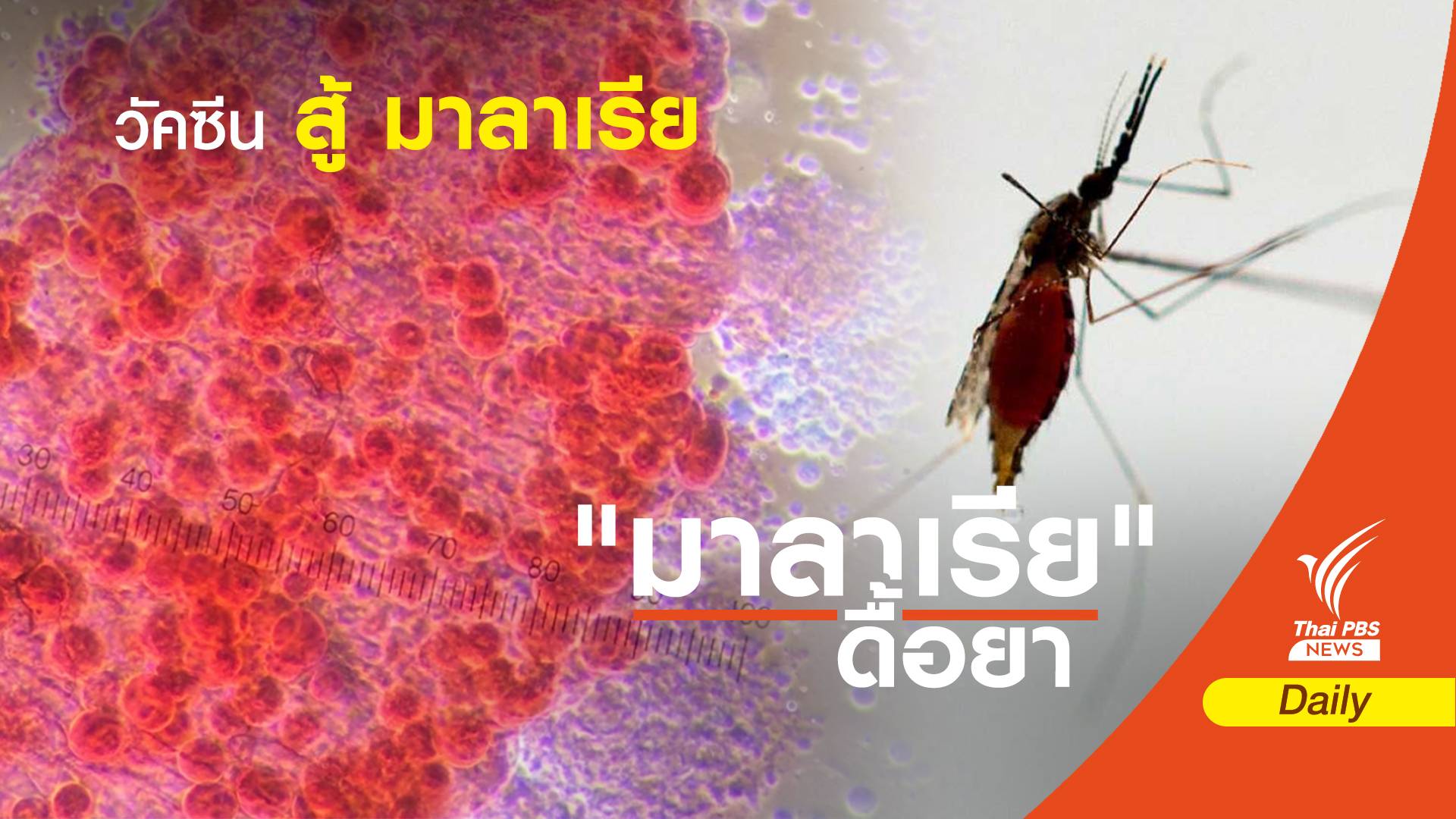 นวัตกรรม “ฟาสต์แทร็ก” ย่นเวลาพัฒนาวัคซีน สู้ “มาลาเรีย”