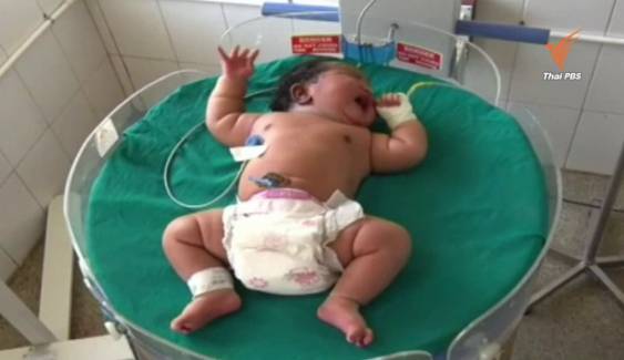 หญิงอินเดียวัย 19 ปี คลอดทารกเพศหญิงน้ำหนักถึง 6.8 ก.ก. หนักสุดในประเทศ