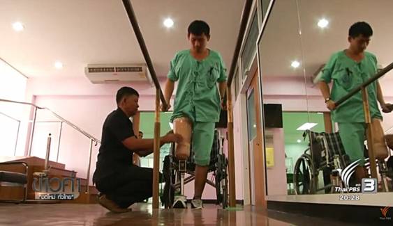 แขนเทียม-ขาเทียมเพื่อชีวิตใหม่ พระมหากรุณาธิคุณของในหลวงต่อผู้พิการ 