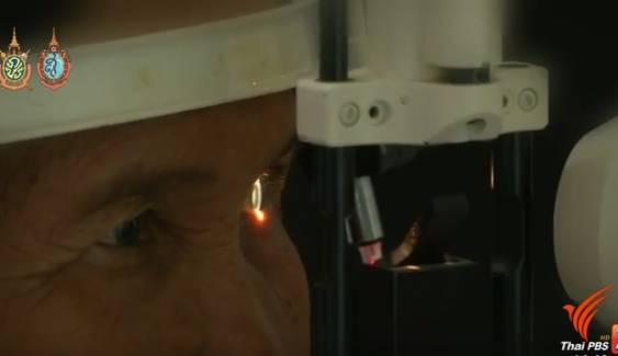 ผู้สูงอายุชายแดนใต้ "ปลื้ม"สถาบันพระปกเกล้าผ่าตัดแก้ต้อกระจกฟรี 
