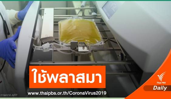 "หมอยง" เผยไทยใช้พลาสมารักษาต่างชาติป่วย COVID-19