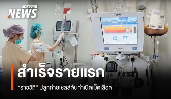 "ราชวิถี" ปลูกถ่ายเซลล์ต้นกำเนิดเม็ดเลือด สำเร็จเป็นรายแรก 