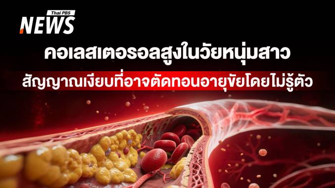 &quot;คอเลสเตอรอลสูง&quot; เมื่อโรคหัวใจเริ่มต้นก่อนวัย ทางรอดอาจอยู่ใน &quot;ยีน&quot;