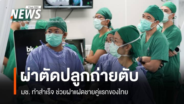 มช.สร้างประวัติศาสตร์ ผ่าตัด "ปลูกถ่ายตับ" ให้ฝาแฝดคู่แรกไทยสำเร็จ