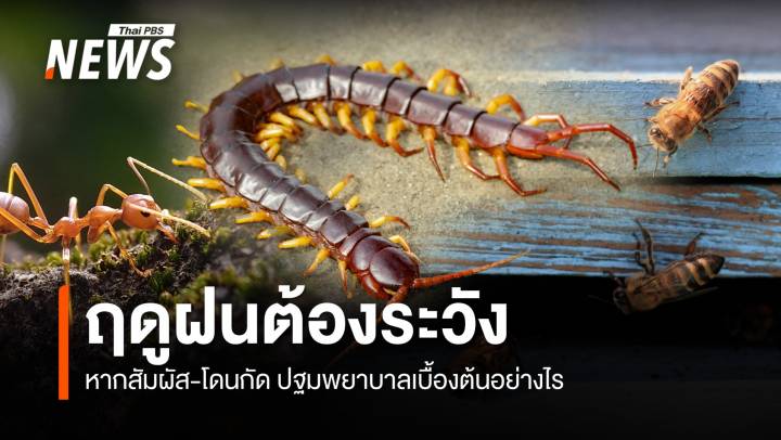 ฤดูฝนต้องระวัง "แมลง-สัตว์-สัตว์ขาข้อ"  รู้วิธีปฐมพยาบาลเบื้องต้น เมื่อถูกกัด-ต่อย