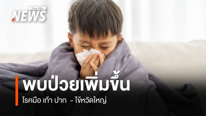เตือน "โรคมือ เท้า ปาก - ไข้หวัดใหญ่" พบแนวโน้มสูงขึ้น   