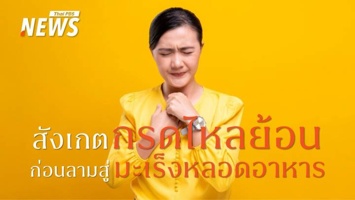 กรดไหลย้อนเรื้อรัง สัญญาณเตือนอาจนำไปสู่ "มะเร็งหลอดอาหาร"