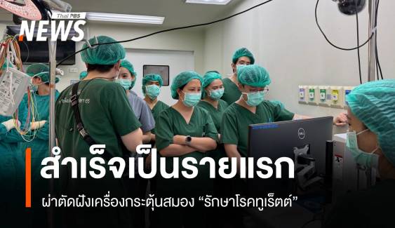 ผ่าตัดฝังเครื่องกระตุ้นสมอง "รักษาโรคทูเร็ตต์" สำเร็จรายแรก