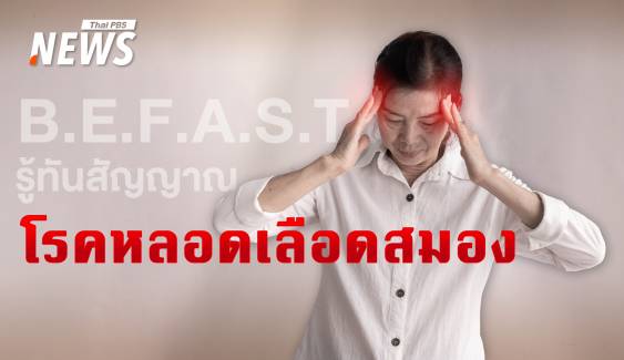 B.E.F.A.S.T. รู้ทันสัญญาณ "โรคหลอดเลือดสมอง"