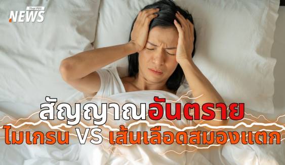 ไมเกรน VS เส้นเลือดสมองแตก ปวดหัวแบบไหน อันตรายถึงชีวิต ? 